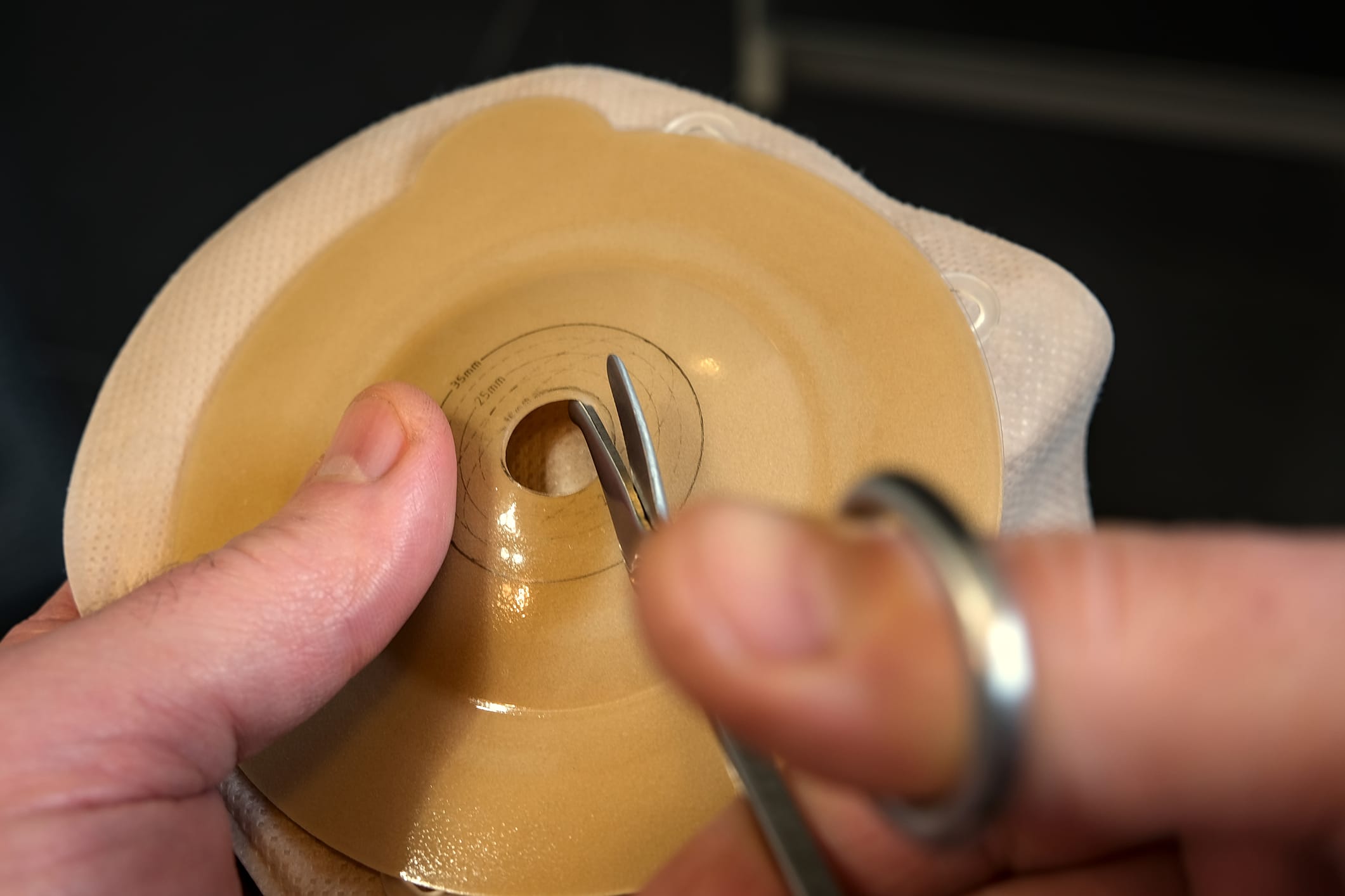 Close up of hands trimming a pouch flange with scissors for custom medical fit and stoma care.