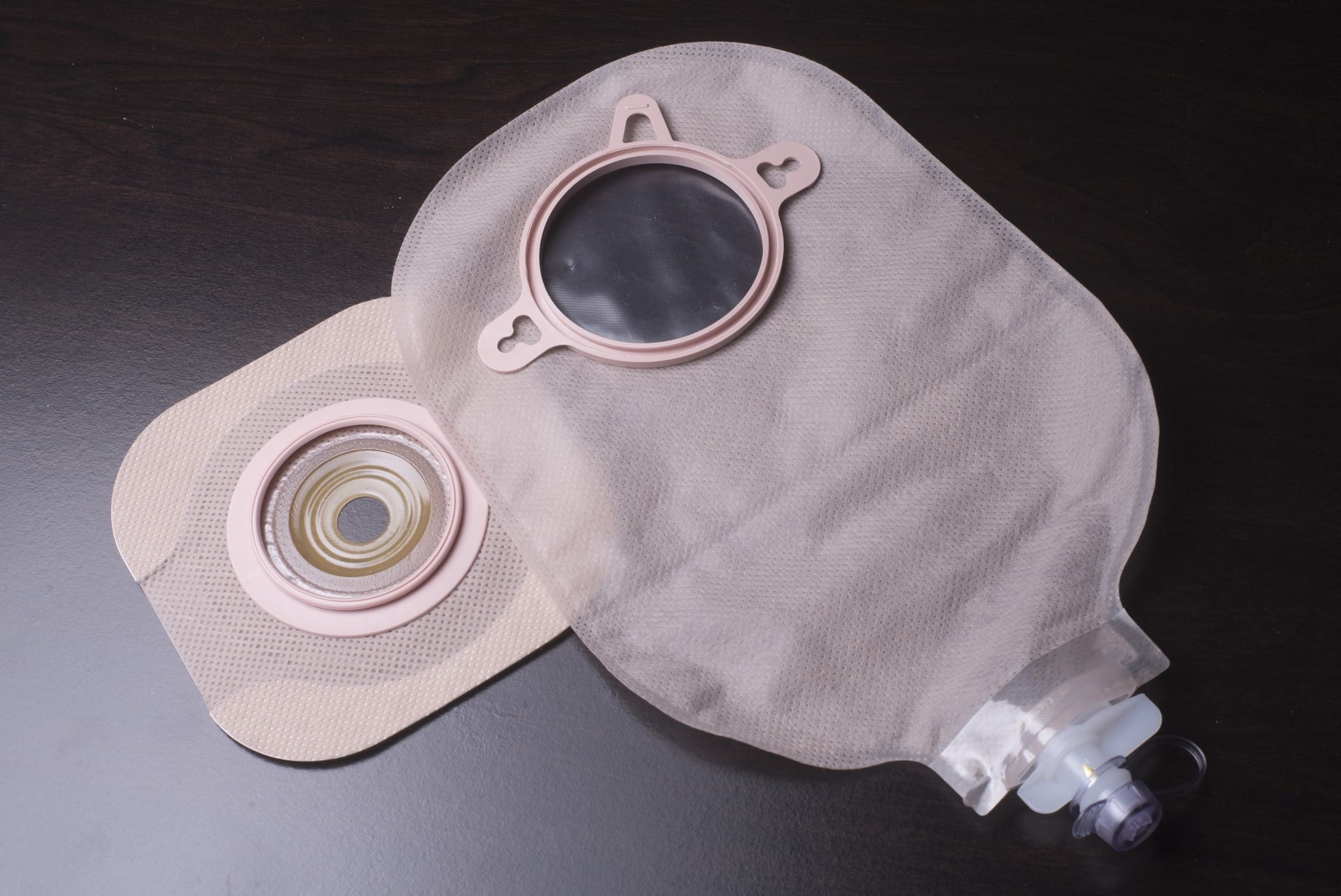 Stoma bag for urostomy patient